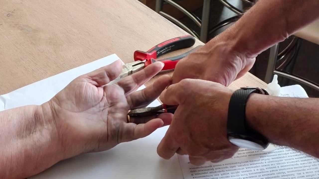 Спасатели помогли жительнице Йошкар-Олы избавиться от обручального кольца