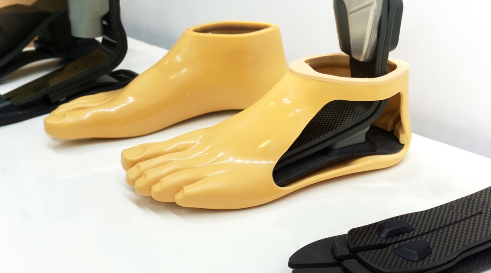 Для получения протезно-ортопедической помощи необходимо обратиться в Минсоцразвития