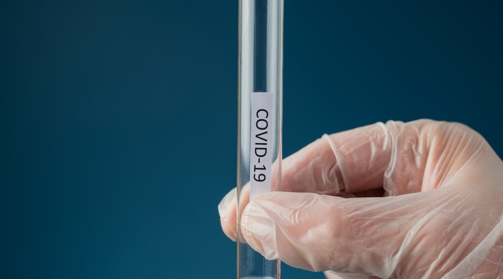 В Марий Эл с начала месяца COVID-19 заболели 78 человек