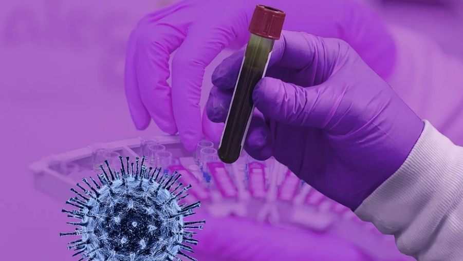 В Марий Эл половина заболевших коронавирусом переносят болезнь в лёгкой форме