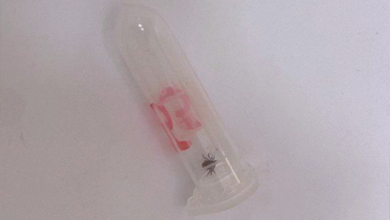 В Марий Эл за неделю от укусов клещей пострадали около 100 человек