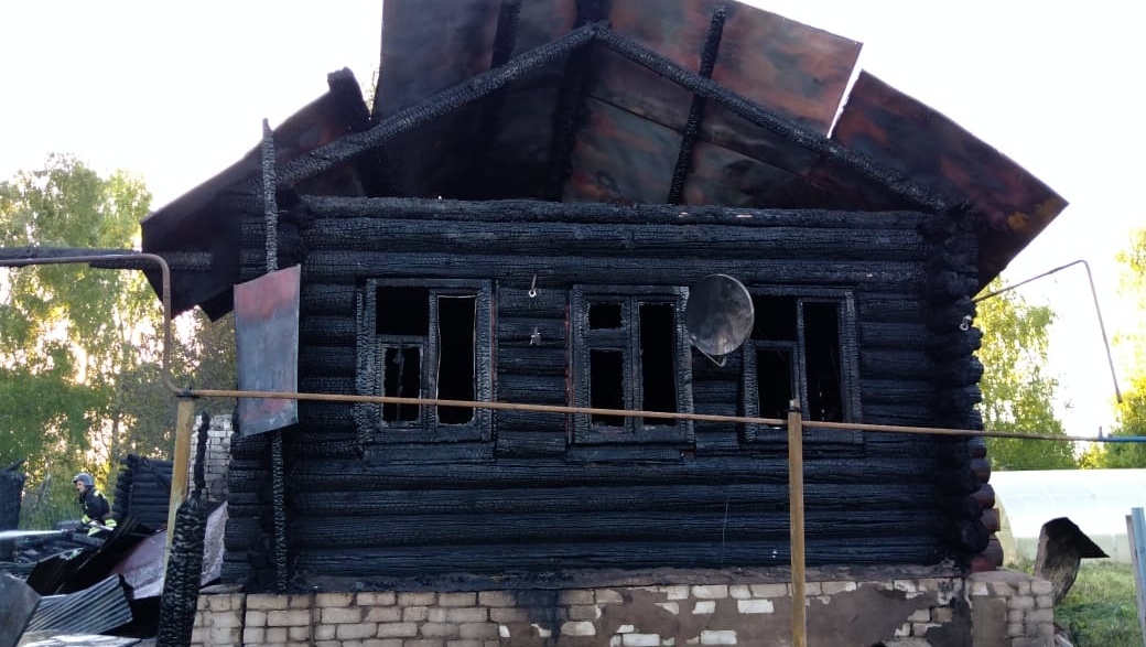 В Марий Эл при попытке потушить пожар 82-летняя пенсионерка получила ожоги